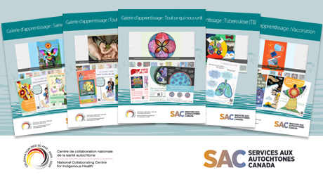 Galerie d'art de SAC et du CCNSA sur la prévention des maladies transmissibles